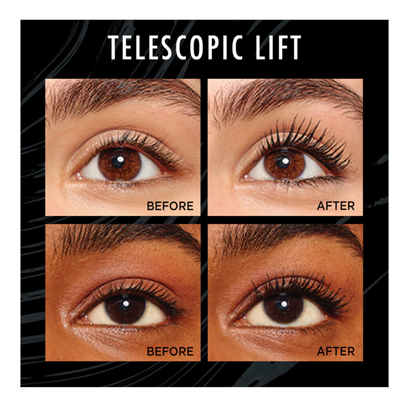 L&
