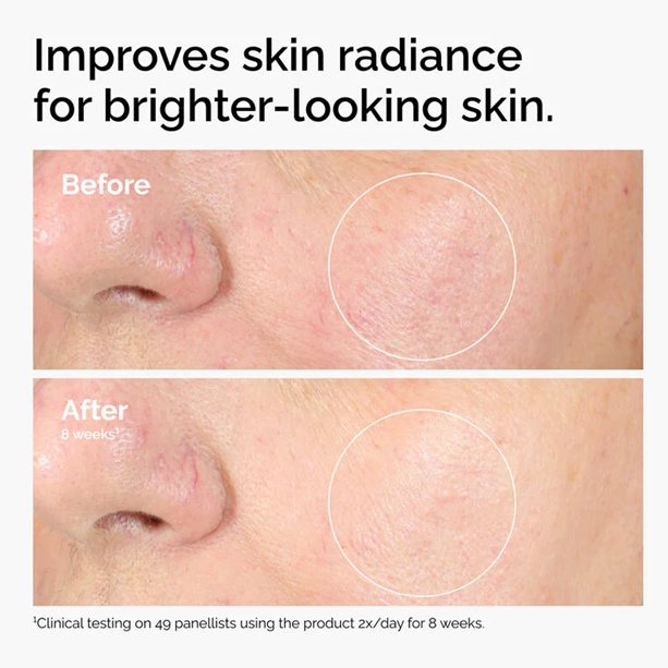 The Ordinary Alpha Arbutin 2% + HA 30ml
