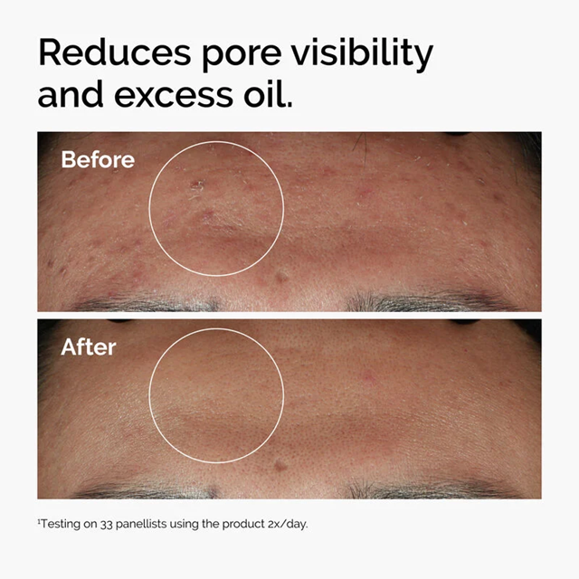 THE ORDINARY Niacinamide 10% + Zinc 1% 30ml