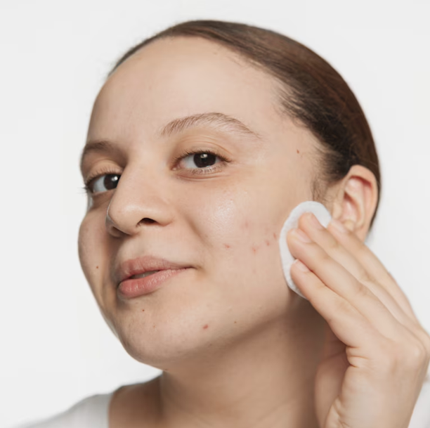 CLINIQUE ANTI-BLEMISH LOTION 200ML