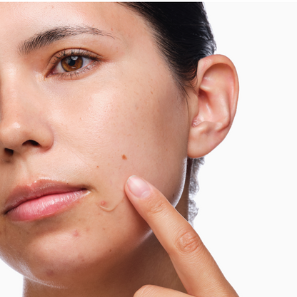 THE ORDINARY THE ACNE SET