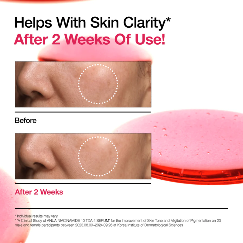 ANUA 10+ NIACINAMIDE + TXA SERUM 30ML
