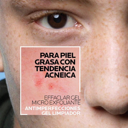 LA ROCHE POSAY EFFACLAR GEL MICROEXFOLIANTE 200ML
