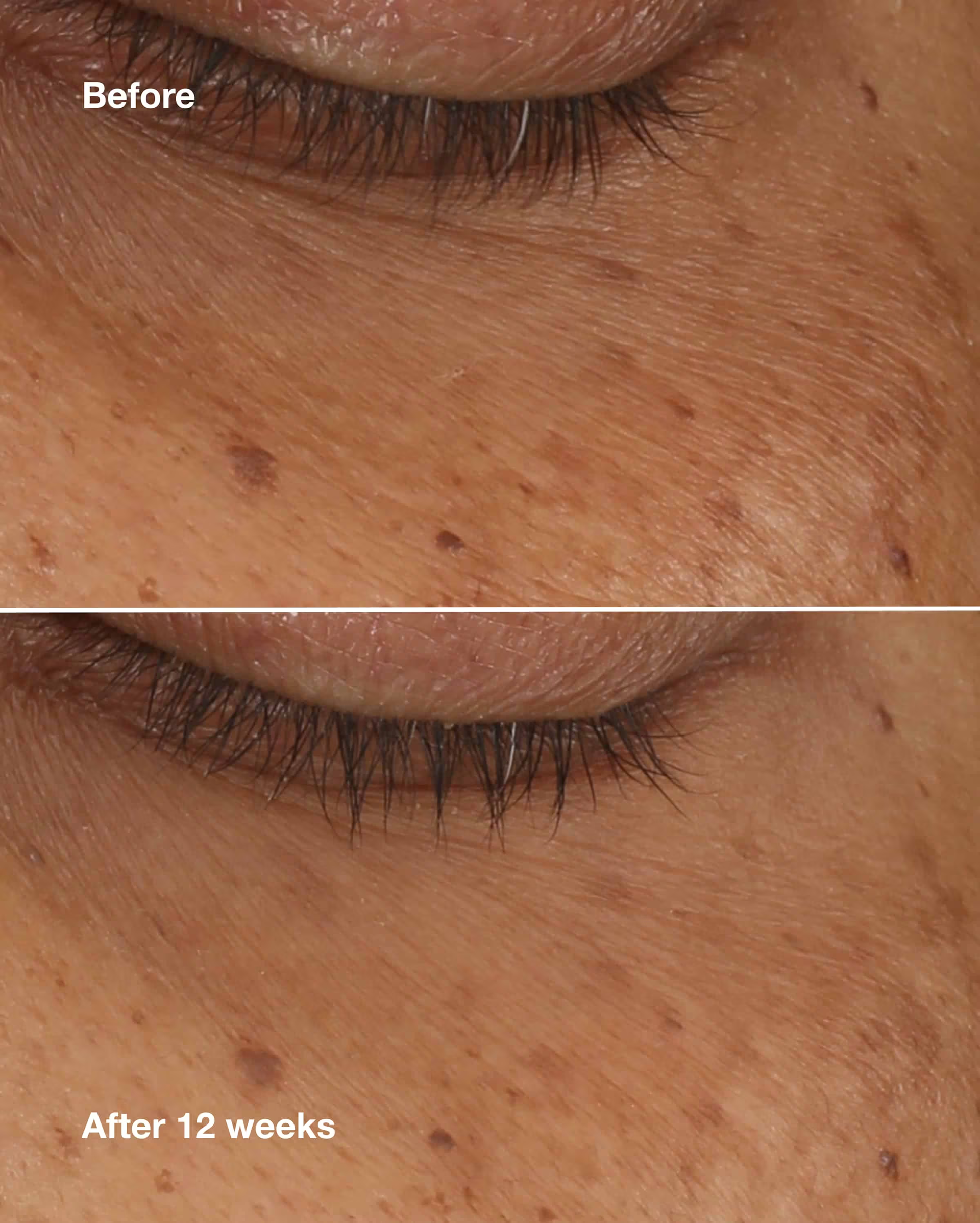 CLINIQUE ALL ABOUT EYES BRIGHTENING SERUM CONCENTRATE 10ML