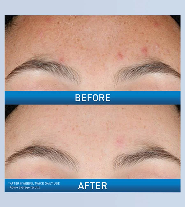 CERAVE RETINOL RESURFACING SERUM 30ML
