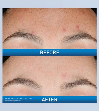 CERAVE RETINOL RESURFACING SERUM 30ML