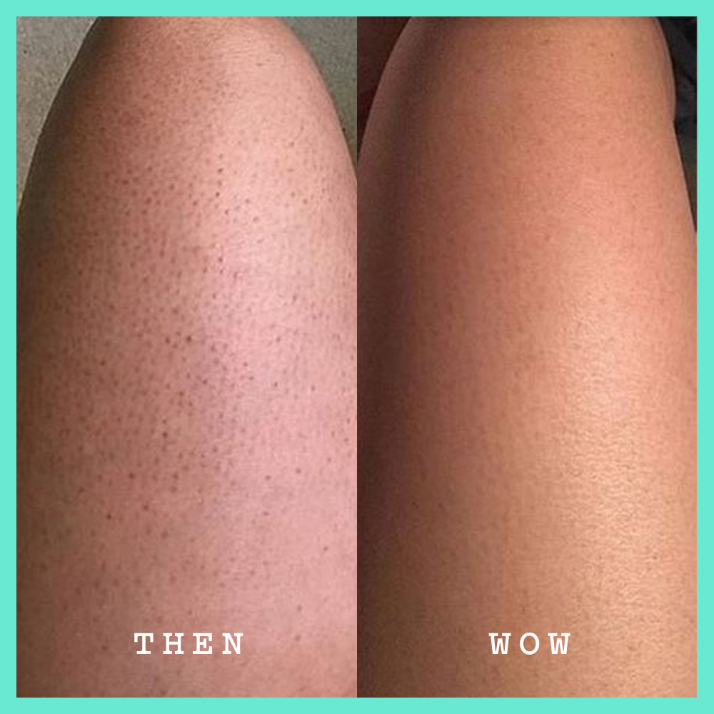 Frank Body Glycolic Scrub 250g