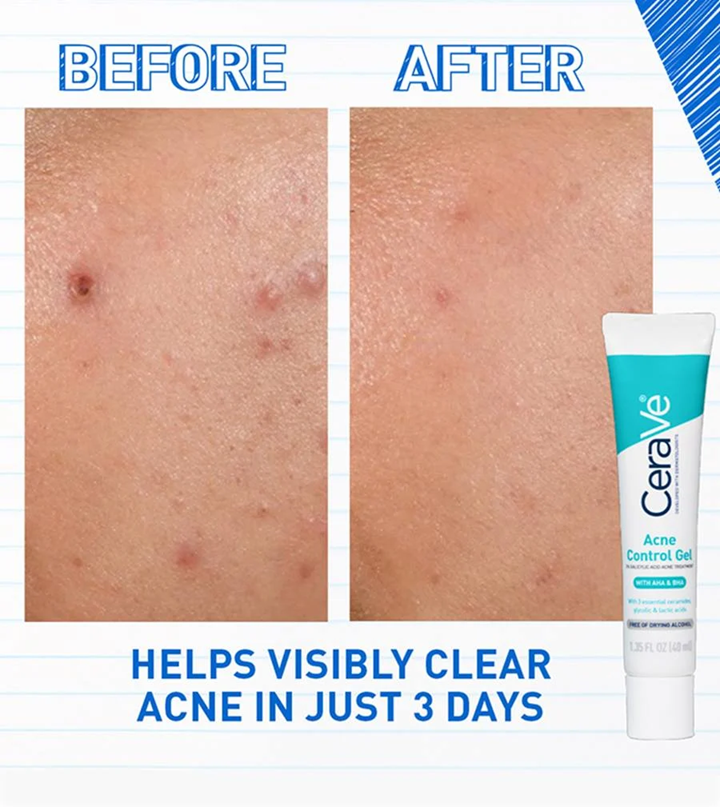 CERAVE ACNE CONTROL GEL 40ML