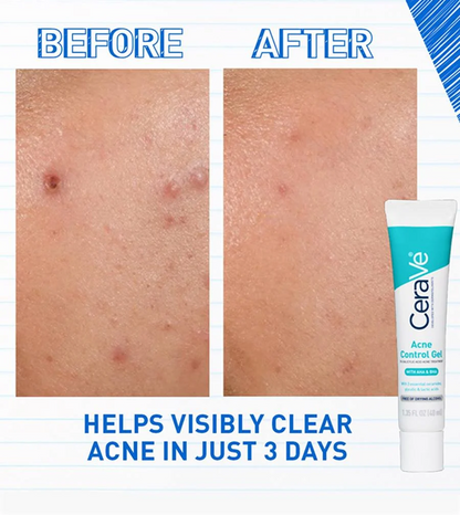 CERAVE ACNE CONTROL GEL 40ML