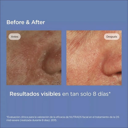 ISDIN NUTRADEICA DS FACIAL GEL CREAM 50ML