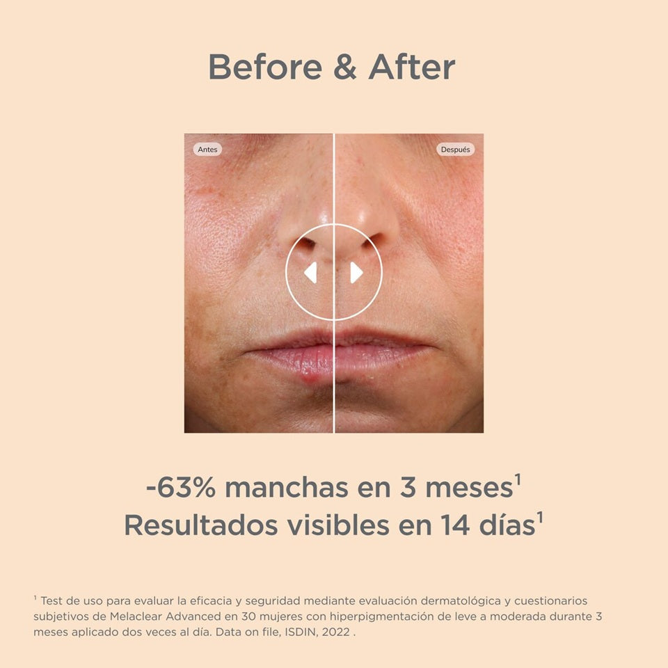 ISDIN MELACLEAR ADVANCED SERUM 30ML