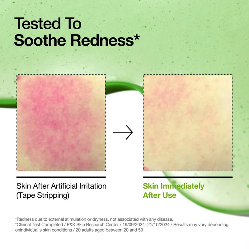 ANUA AZELAIC ACID 10 + HYALURON SERUM 30ML