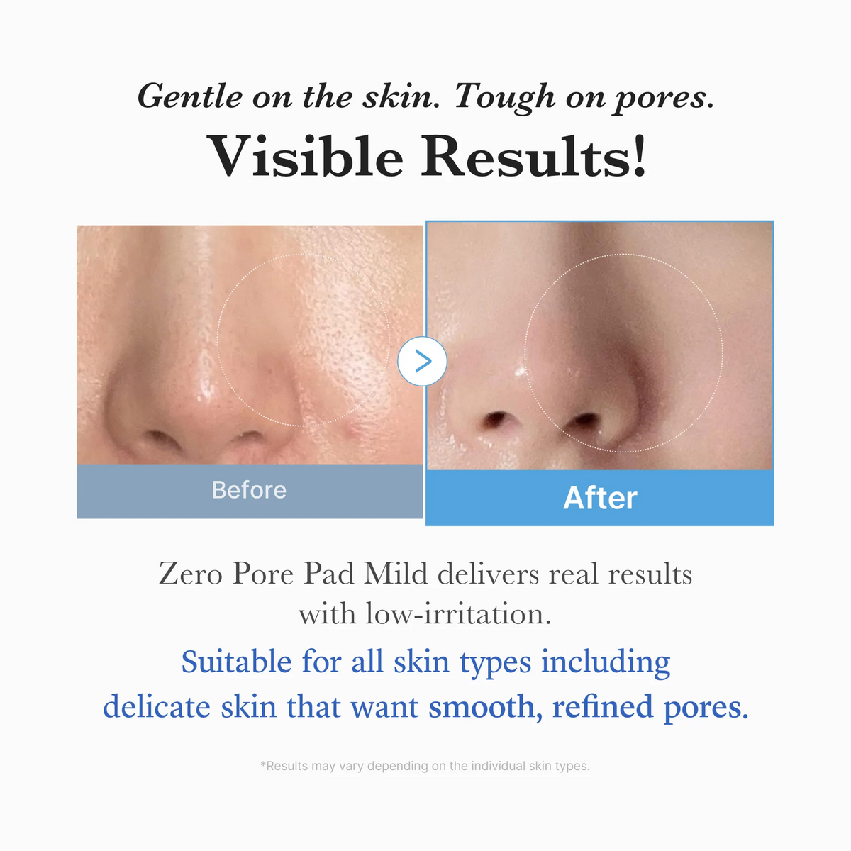 MEDICUBE ZERO PORE PAD MILD