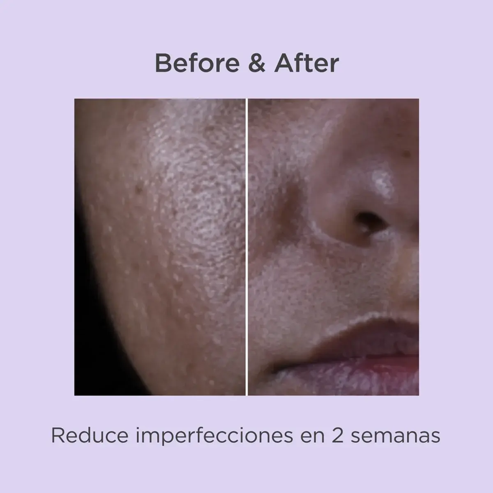 ISDIN SALICYLIC RENEWAL SERUM 30ML