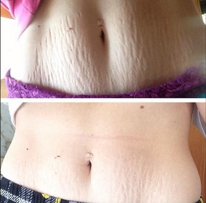 Frank Body Abeauty Scrub